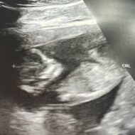 Bienvenida Manuela